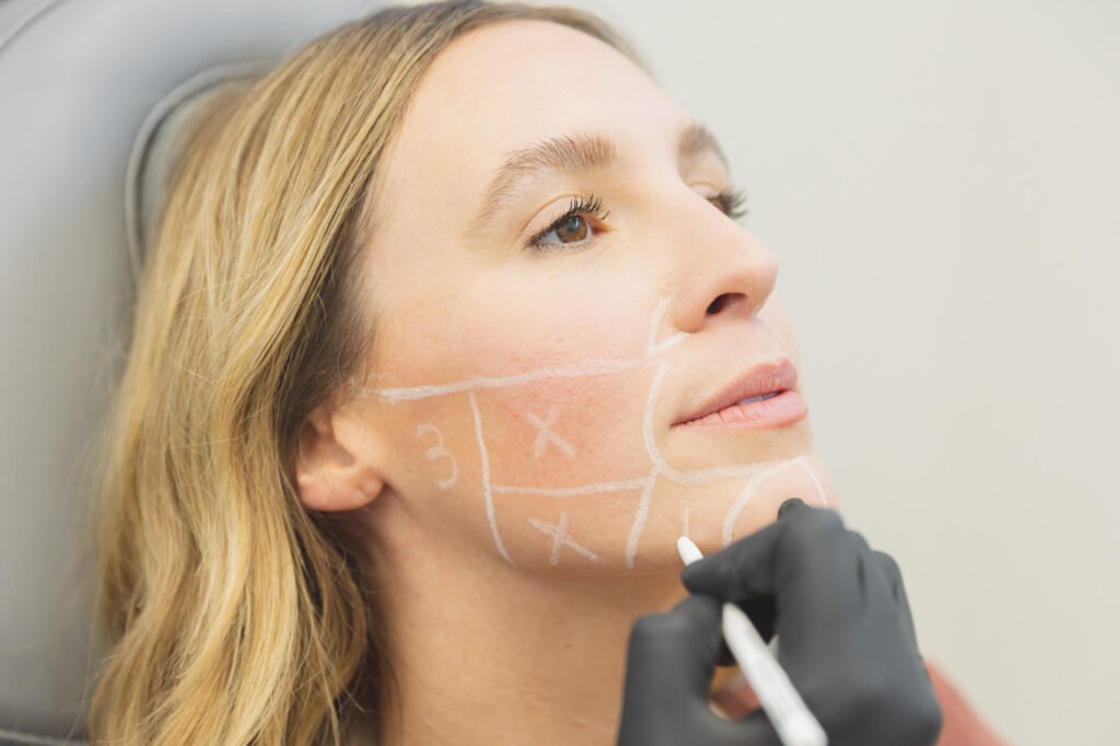 Sculptra: como funciona esse bioestimulador de colágeno?